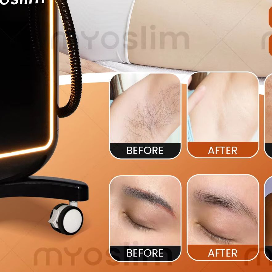 Hair Care Or Haircare - Multifunctional 4 IN 1 Diode Laser