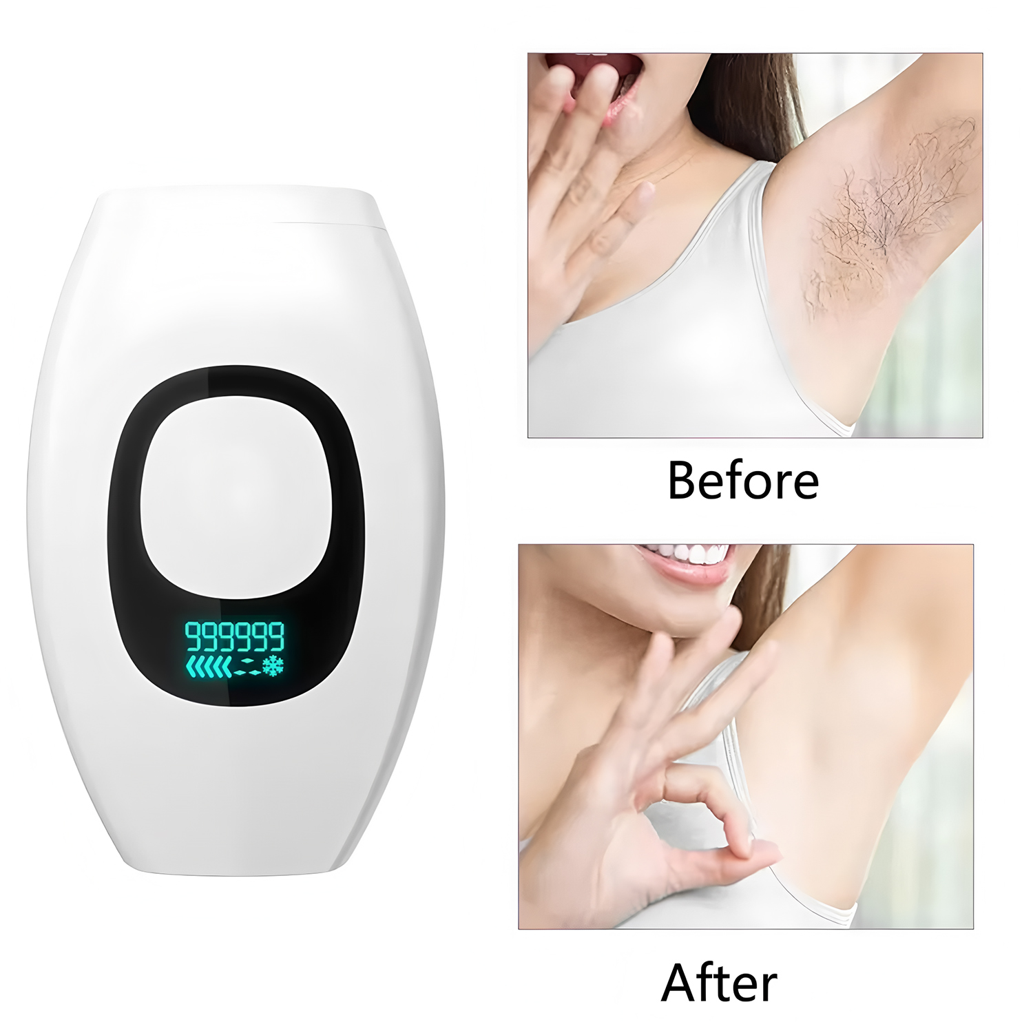 From Home Hair Care - Beauty Care IPL Hair Removal Device