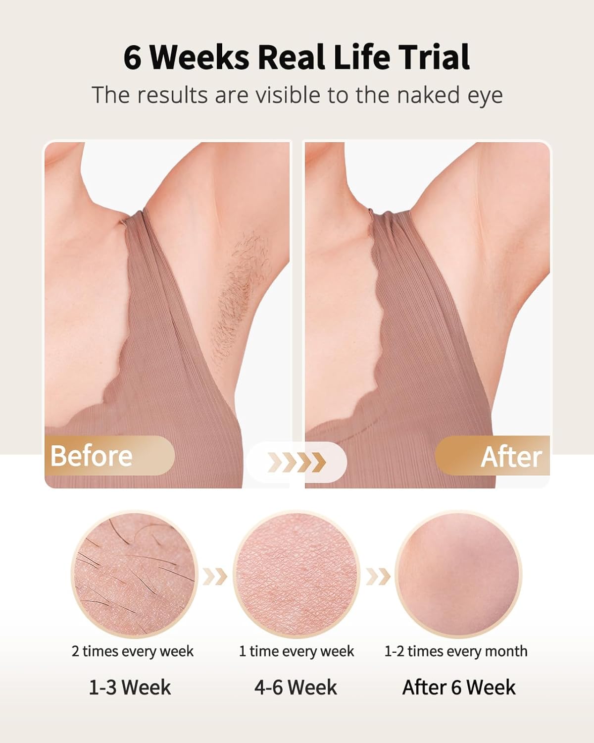 Laser Hair Removal with Ice Co - Hair Care Or Haircare review and price