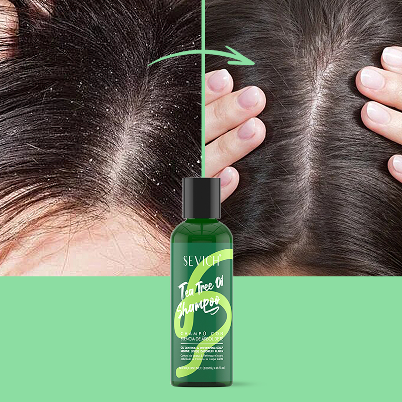 Tea Tree Essence Shampoo Hair  - Hair Care Essence review and price