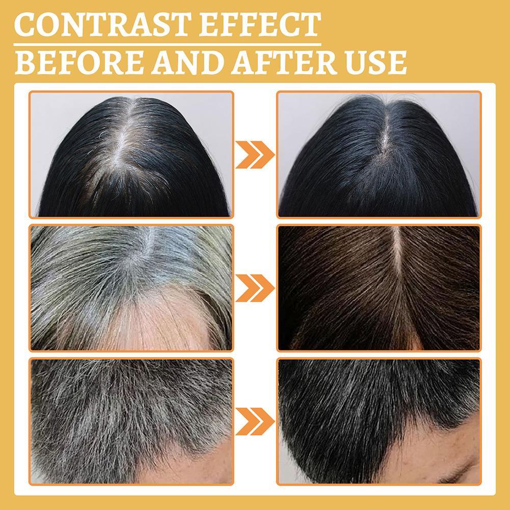 1/2PCS Hair Growth Serum Oil,  - Hair Care Natural Products review and price