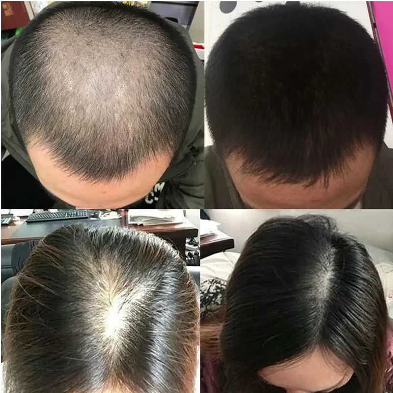 Overlord Plant Hair Growth Liq - Hair Care Or Haircare review and price