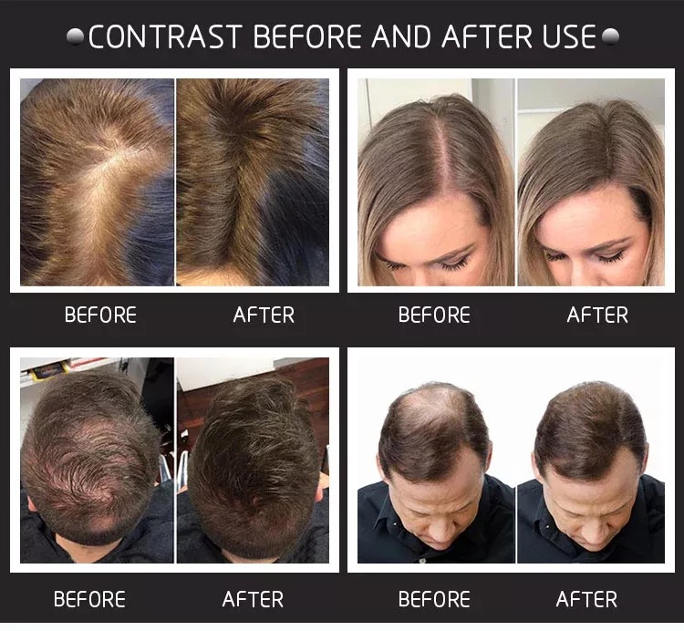 28g Hair Building Fibers Come  - Hair Care Natural Products review and price