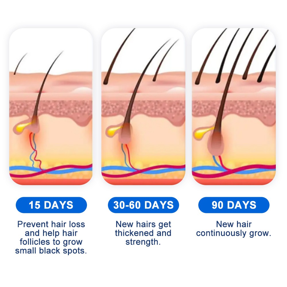 Alopecia Hair Growth Spray Sop - Hair Care Growth review and price