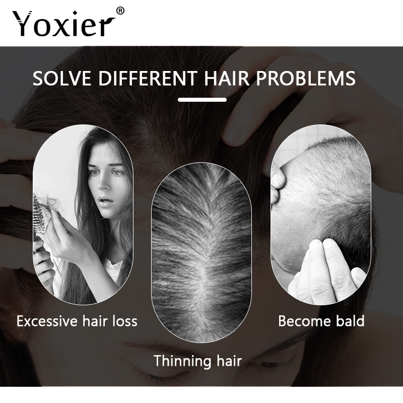 Intensive Growth Serum Prevent - Hair Care Growth review and price