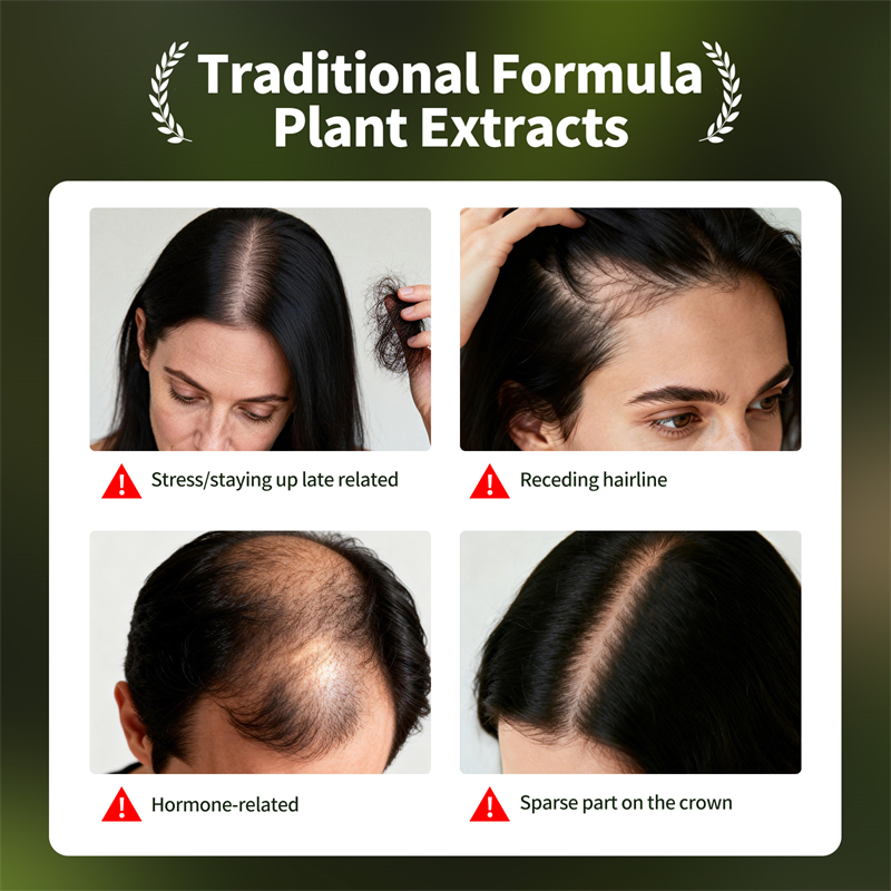 Natural Hair Growth Set Usman  - Hair Care Natural Products review and price