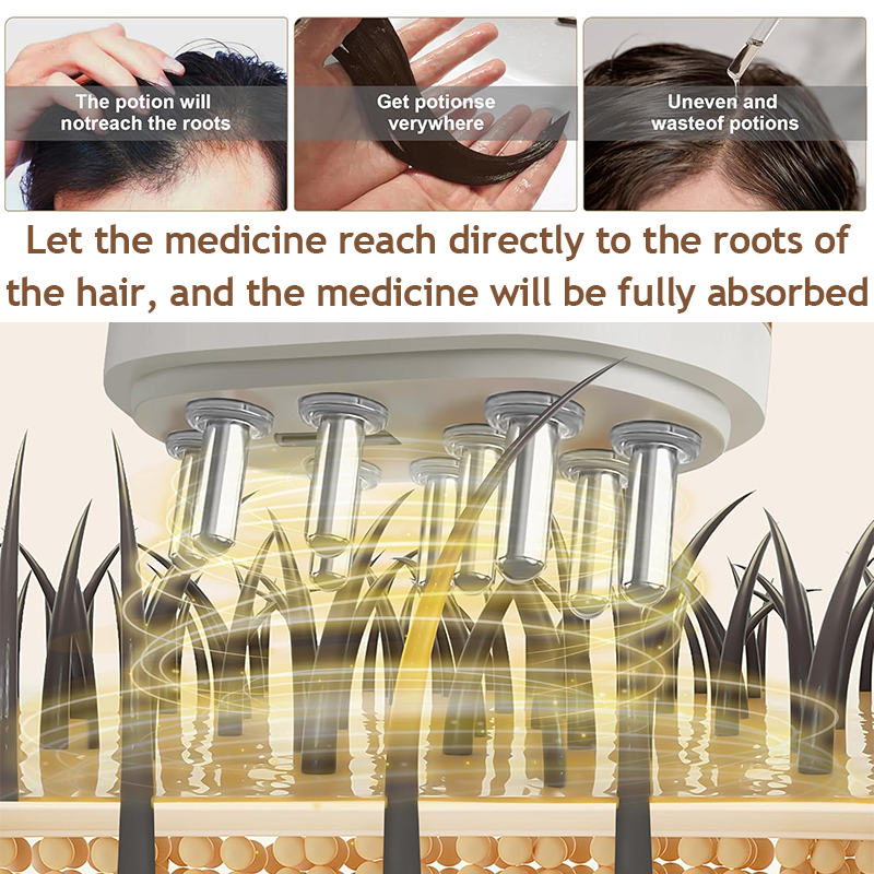 Electric Vibration Scalp Essen - Hair Care Essence review and price