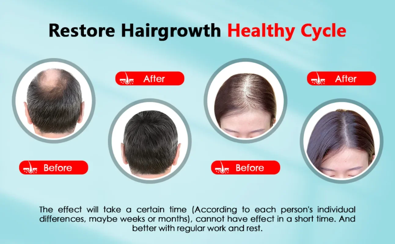 Hair Growth Cap Rechargeable 2 - Hair Care Basic review and price