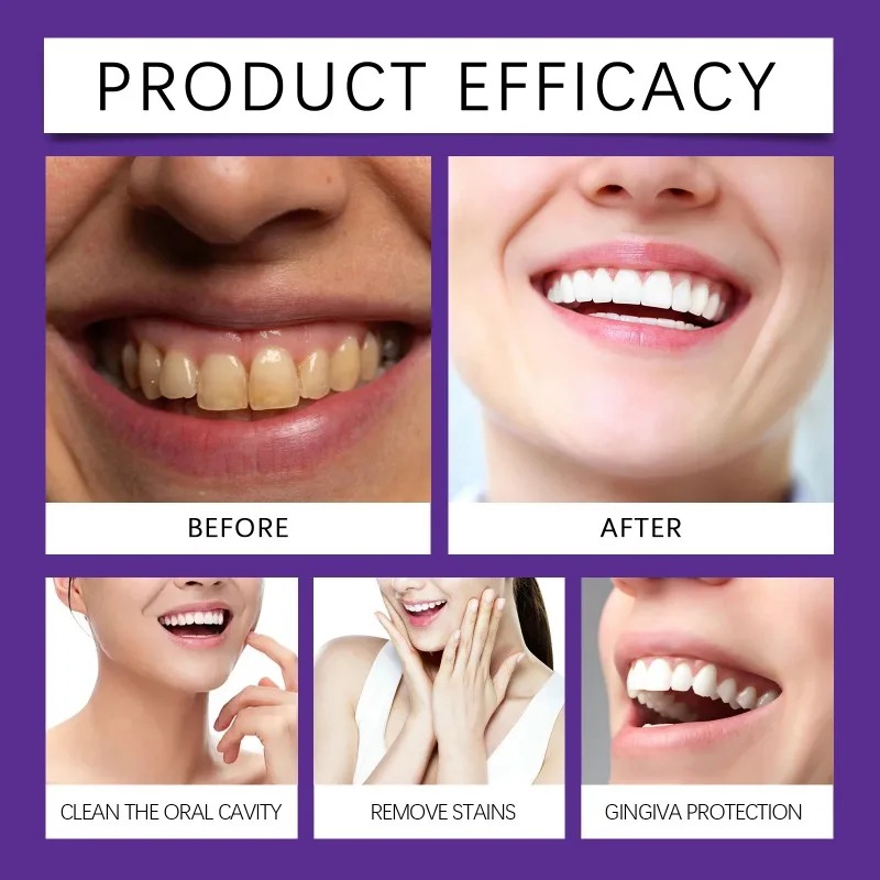 Purple Teeth Restoration Miner - Purple Toning Shampoo review and price