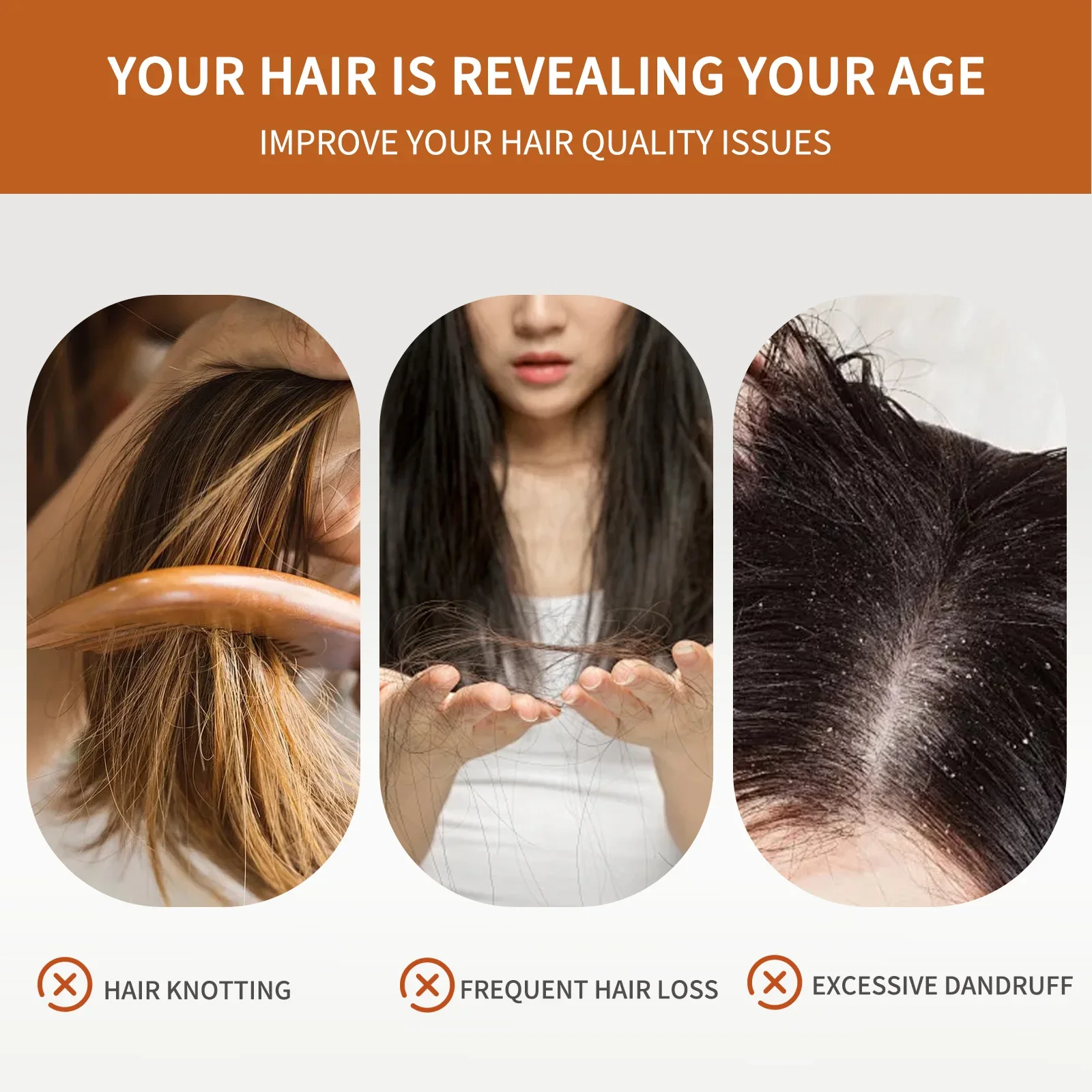 4 Bars of Anti-Hair Loss Shamp - Hair Care Basic review and price
