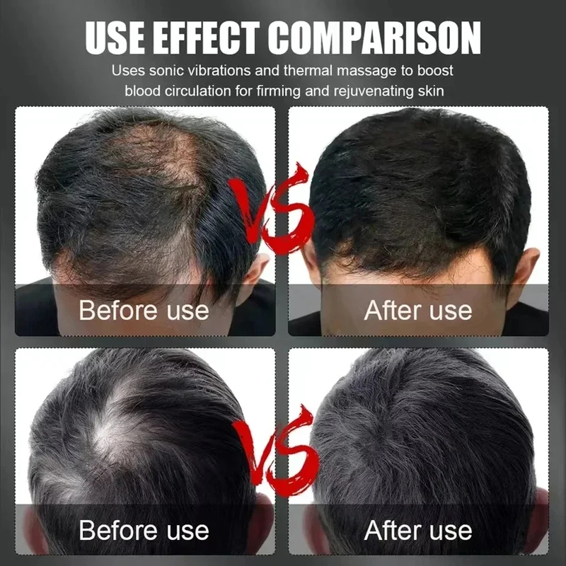 660nm 850nm Red Light Infrared - Hair Care Growth review and price